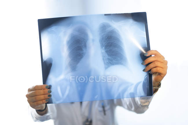 Close-up of female doctor in uniform looking at x-ray image in room — Stock Photo