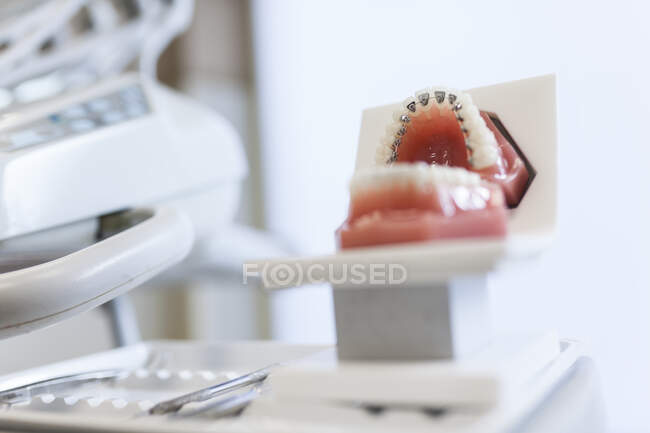Mâchoire factice avec accolades sur la table dans l'armoire dentaire dans la clinique de stomatologie — Photo de stock