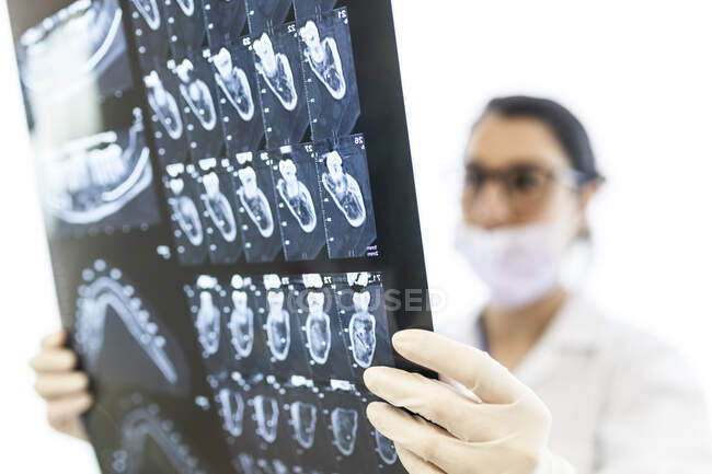 Dentista femenino revisando la radiografía del paciente - foto de stock