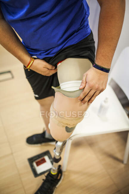 Jovem amputado testando a nova prótese de perna — Fotografia de Stock