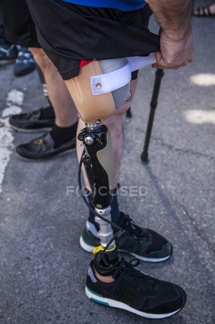 Jovem irreconhecível amputado com sua prótese de perna — Fotografia de Stock