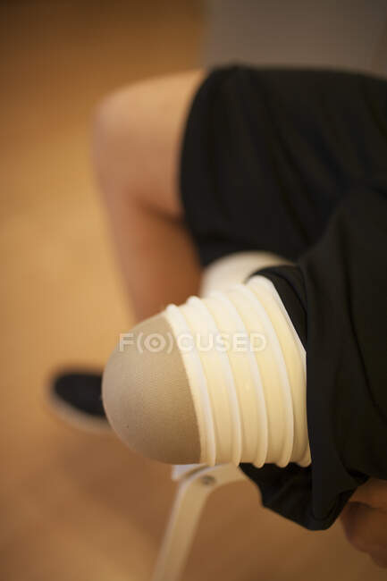 Amputee waiting for prosthesis — Stock Photo