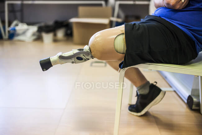 Amputated young man testing the new leg prosthesis — Stock Photo