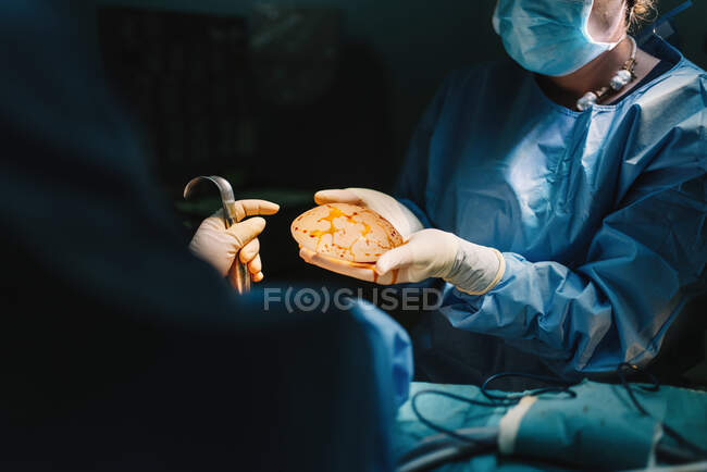 Лікар у хірургічній сукні, що тримає приготовлений силіконовий імплантат для мамопластики та медсестри, яка доглядає за врожаєм під час операції. — Stock Photo