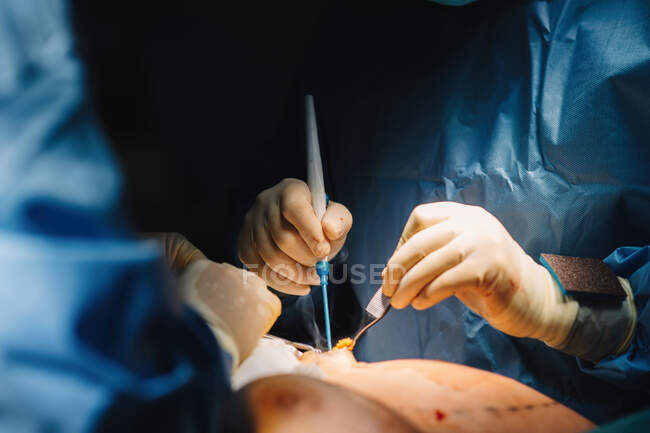 Crop unrecognizable person hands making surgery with instruments and crop nurse — Stock Photo