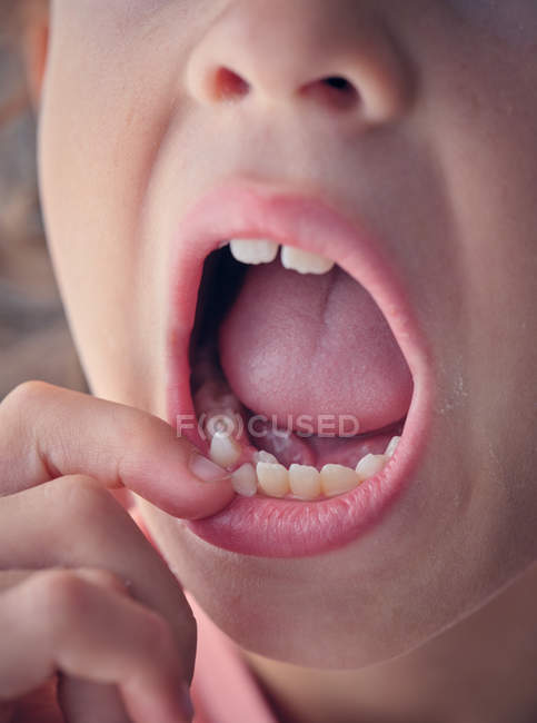 Unsteady baby tooth in wide open mouth of anonymous child pulling lip down to show tooth — Stock Photo