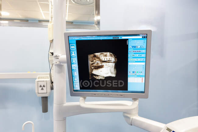 Monitor su sedia dentale con foto dei denti — Foto stock