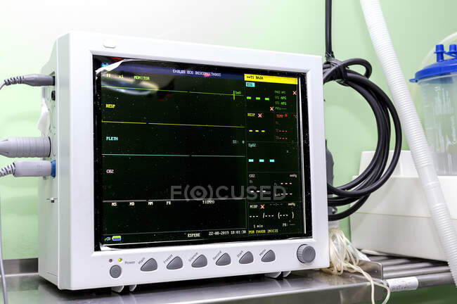 Monitor eletrônico exibindo sinais vitais e frequência cardíaca do paciente na sala de cirurgia da clínica moderna — Fotografia de Stock