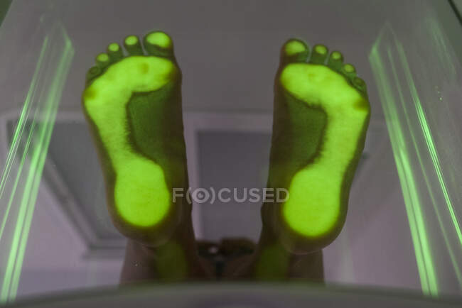 Foot step scanning of patient — Stock Photo