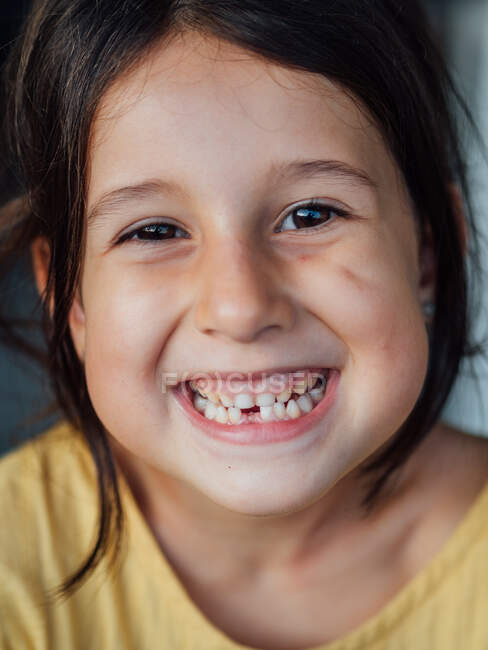 Menina sem dentes sorrindo para a câmera — Fotografia de Stock