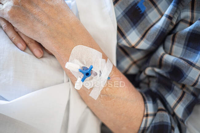 Paciente anciano de cultivo superior con catéter intravenoso en brazo acostado bajo manta y durmiendo - foto de stock