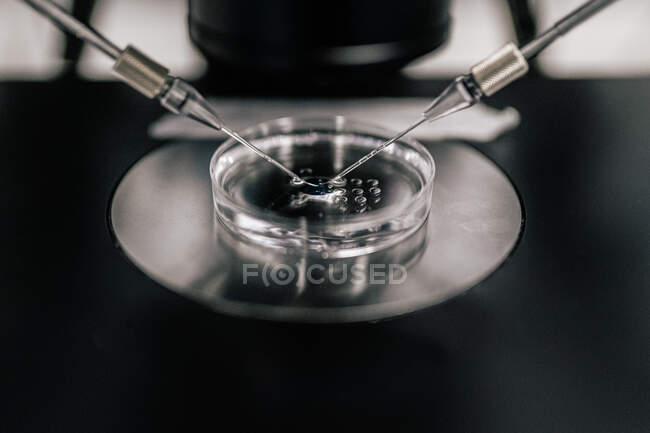 Agujas delgadas de primer plano que insertan esperma en el óvulo durante el proceso de fertilización en la clínica moderna - foto de stock