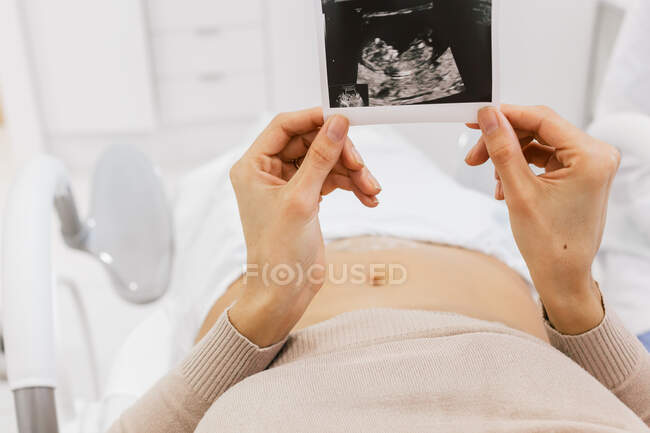 Cropped unrecognizable pregnant female inspecting sonogram picture while lying on bed in ward of modern fertility clinic — Stock Photo