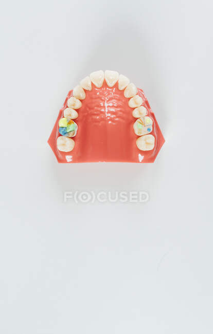 Gros plan d'une prothèse dentaire dans un laboratoire — Photo de stock
