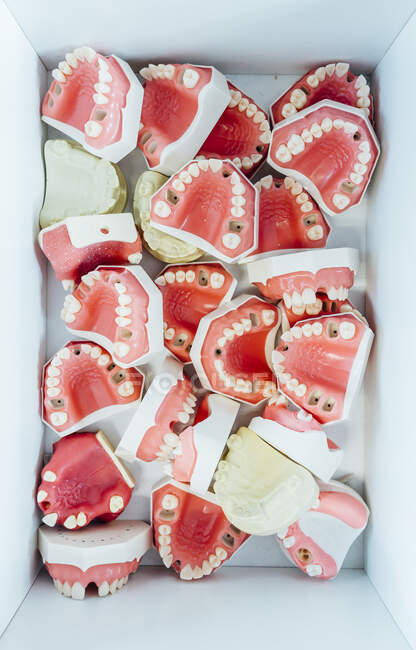 Top view of various models of dental jaws with caries and missing teeth in white container used for training of dentistry students — Stock Photo