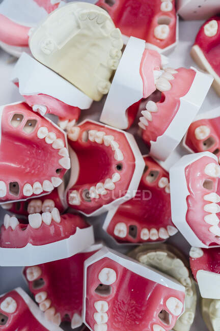Scatola piena di modelli in gesso dentale — Foto stock