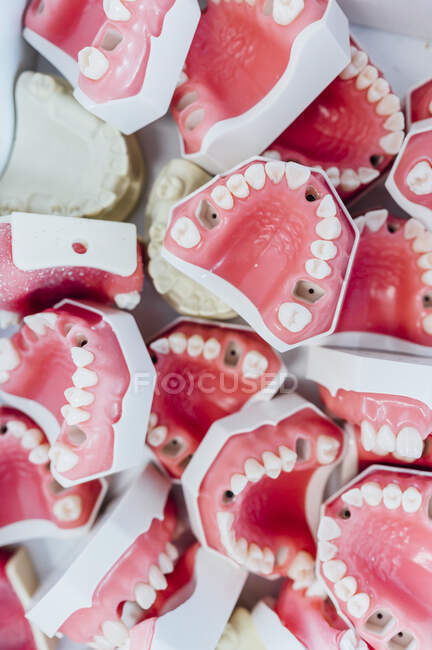 Caja llena de modelos de yeso dental - foto de stock