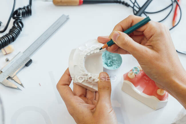 Зверху ортодонта культури з олівцем в руці, що працює з білою зубною формою за столом з професійним обладнанням — стокове фото