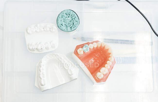 Верхний вид пластикового контейнера с зубной плесенью и протезом, используемых для изучения стоматологии на столе в современной лаборатории — стоковое фото