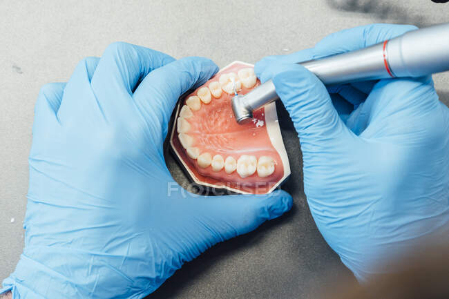 From above cropped anonymous dentist trainee in blue gloves performing dental operation with bur carving dental cast while working in lab — Stock Photo