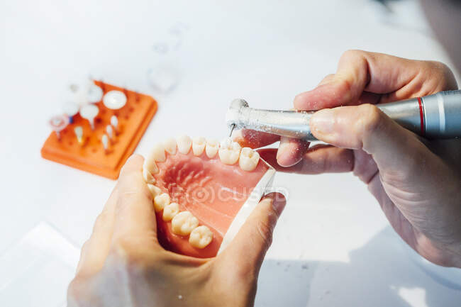 From above cropped anonymous dentist trainee performing dental operation with bur carving dental cast while working in lab — Stock Photo