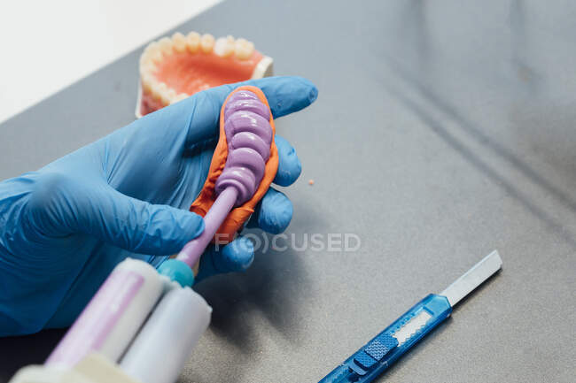 From above of crop orthodontic technician in protective gloves filling mold with material for dental cast while working in modern laboratory — Stock Photo