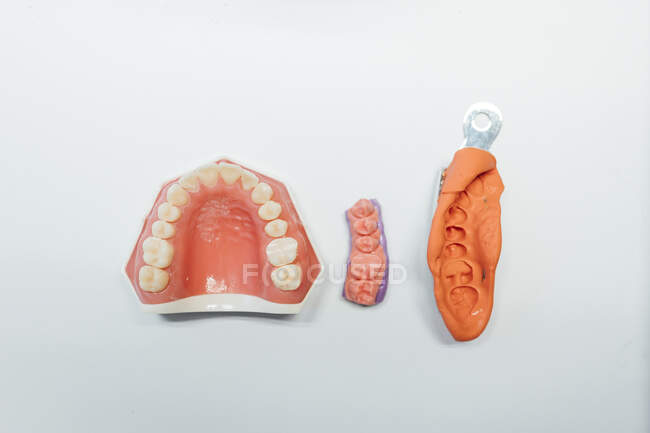 From above of models of dental jaw and crowns placed on table with burnisher and pencils in modern laboratory — Stock Photo