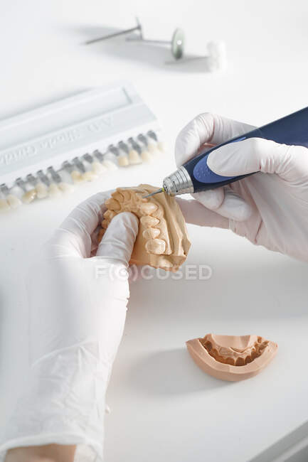 De dessus de la culture dentiste anonyme dans des gants médicaux broyage prothèse dentaire avec outil professionnel tout en travaillant dans un laboratoire moderne — Photo de stock