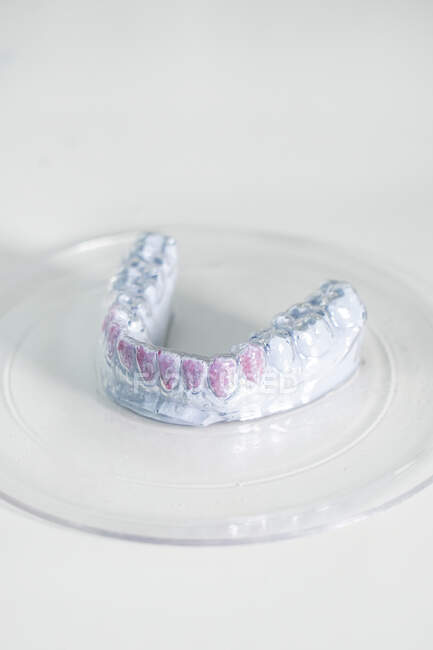 Nahaufnahme eines weißen Gipses mit lackierten Zähnen auf weißer Oberfläche im modernen Labor — Stockfoto