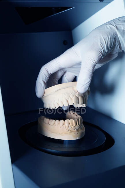 Primer plano del técnico anónimo de cultivos en guantes médicos que trabajan con yeso dental en laboratorio moderno - foto de stock