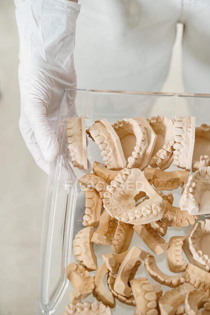 Top view of unrecognizable person hands holding tray with pile of various dental gypsum models of jaws in lab — Stock Photo
