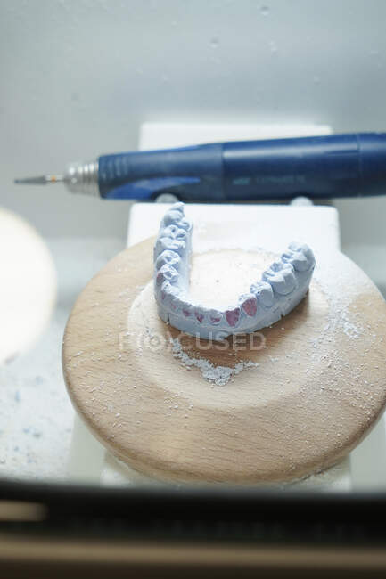 Dall'alto strumento professionale per la rettifica di protesi dentarie in laboratorio moderno — Foto stock