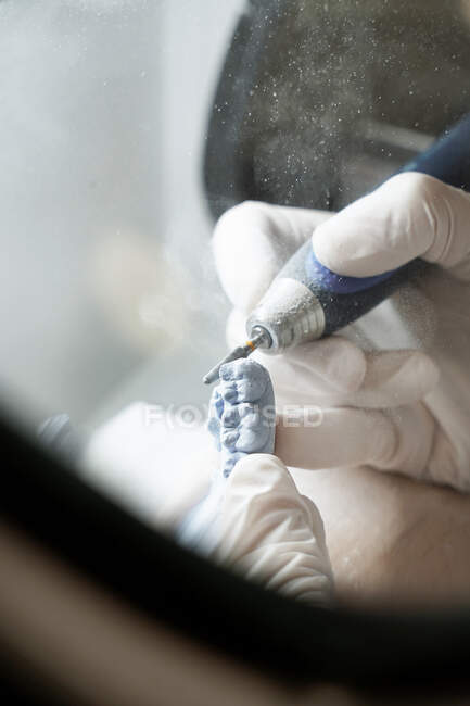De cima de cultura dentista anônimo em luvas médicas moagem prótese dentária com ferramenta profissional enquanto trabalhava em laboratório moderno — Fotografia de Stock