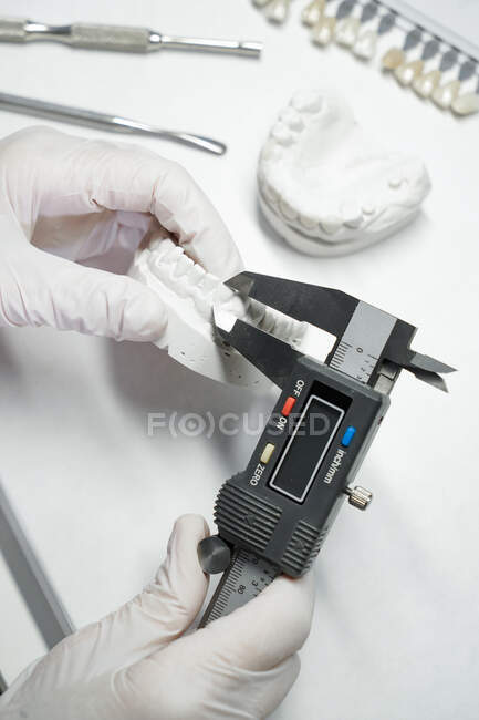 From above of crop anonymous orthodontist using caliper for measuring while working with model of dental jaw in laboratory — Stock Photo