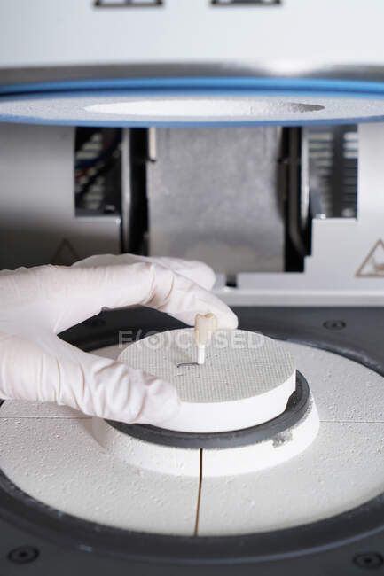 Técnico dental anónimo de cultivo utilizando horno dental durante la producción de implantes dentales en laboratorio moderno - foto de stock