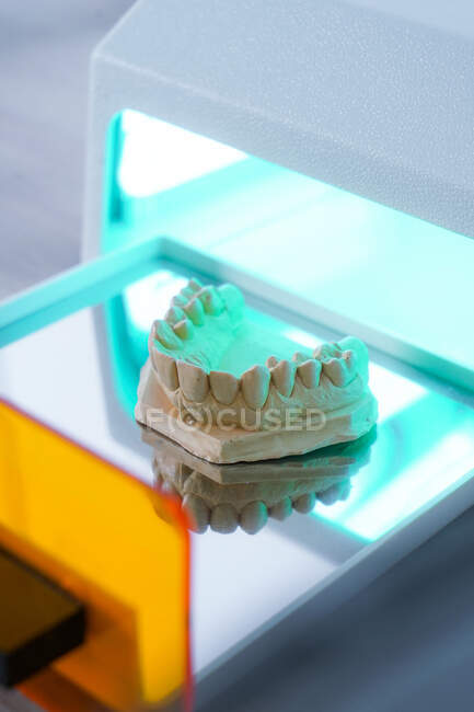 Alto ángulo de la mandíbula superior modelo de yeso dental colocado en la unidad de curado de luz en el laboratorio moderno - foto de stock