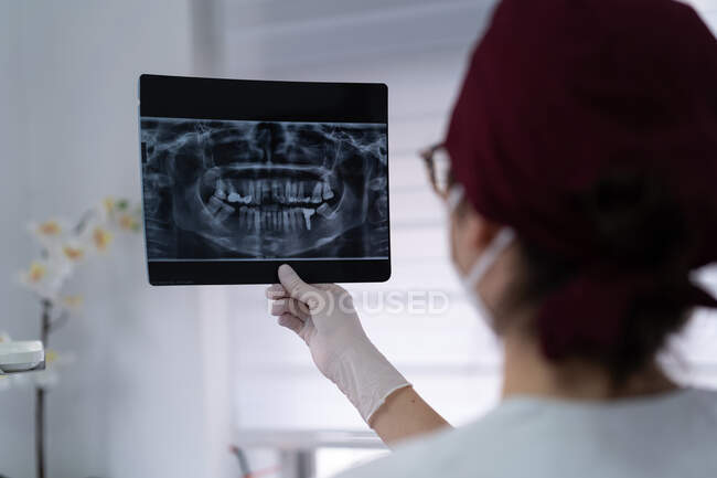 Nachdenklicher Arzt schaut sich Röntgenbild an — Stockfoto