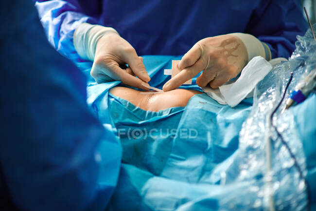 Невпізнаваний хірург прикріпляє клейку пов'язку до післяопераційного сутура на грудях анонімного пацієнтки після збільшення грудей. — Stock Photo