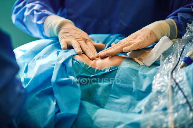 Невпізнаваний хірург прикріпляє клейку пов'язку до післяопераційного сутура на грудях анонімного пацієнтки після збільшення грудей. — Stock Photo