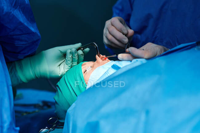 Crop unrecognizable surgeon in protective gloves suturing wound on nose of anonymous patient during rhinoplasty surgery in hospital — Stock Photo