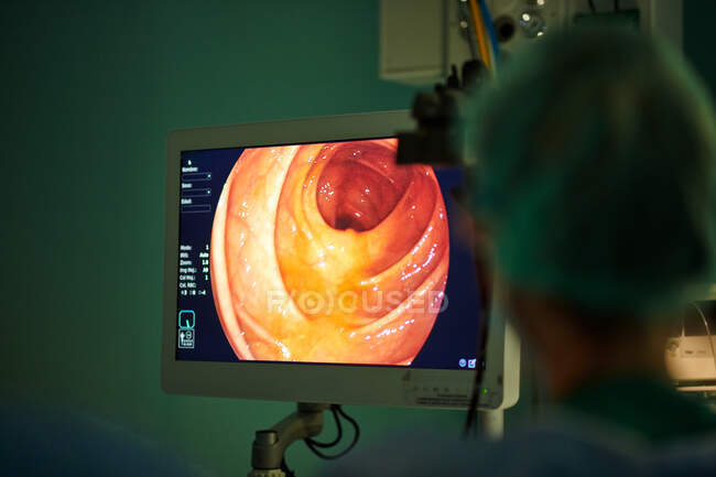 Visão traseira de médico feminino irreconhecível em uniforme olhando para o monitor durante a realização de cirurgia endoscópica na sala de cirurgia moderna — Fotografia de Stock