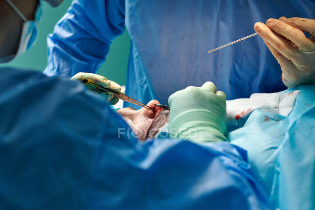 Crop unrecognizable plastic surgeons in gowns and gloves using tweezers while performing rhinoplasty operation in contemporary clinic - foto de stock