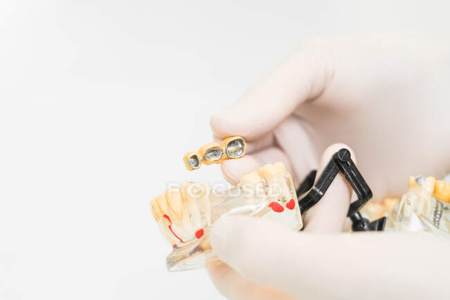 Crop dentista anônimo em luvas de látex de proteção mostrando próteses dentárias com implantes encerar na clínica moderna — Fotografia de Stock