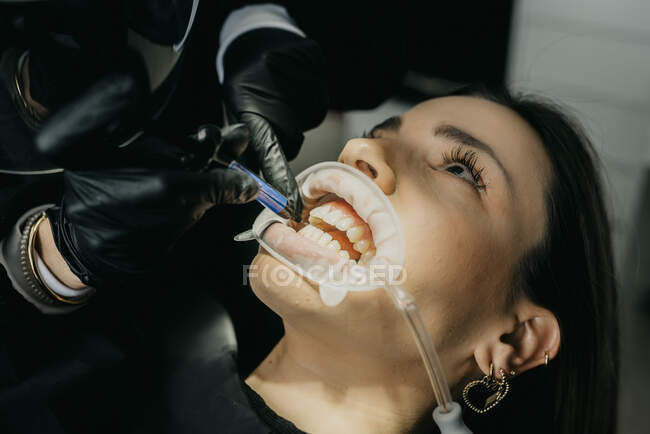 Cosecha dentista irreconocible uputting pasta fotosensible durante el tratamiento de los dientes de la hembra con eyector de saliva y retractor en la boca - foto de stock