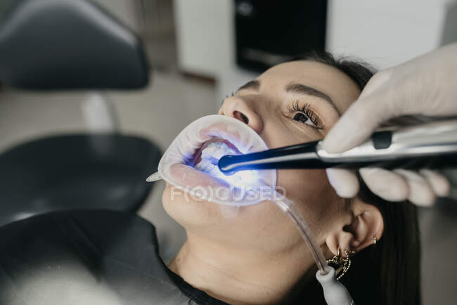 Cosecha dentista irreconocible utilizando la luz de curado dental durante el tratamiento de los dientes de la mujer con eyector de saliva y retractor en la boca - foto de stock
