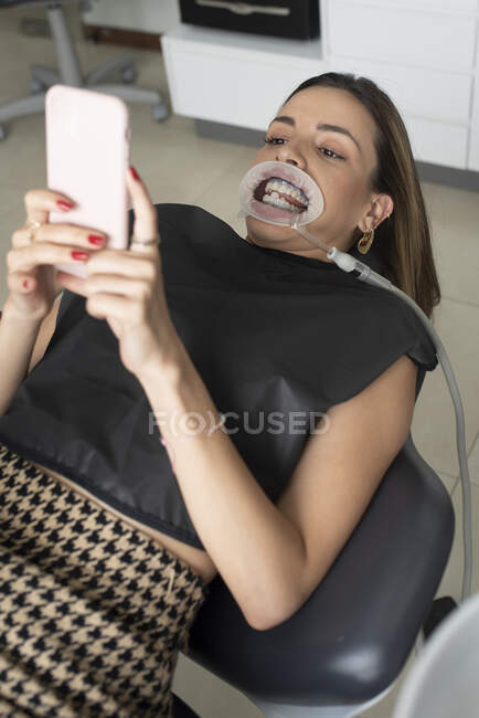 Paciente feminina com afastador na boca deitada na cadeira dentária e tendo auto-tiro no smartphone antes do tratamento na clínica — Fotografia de Stock