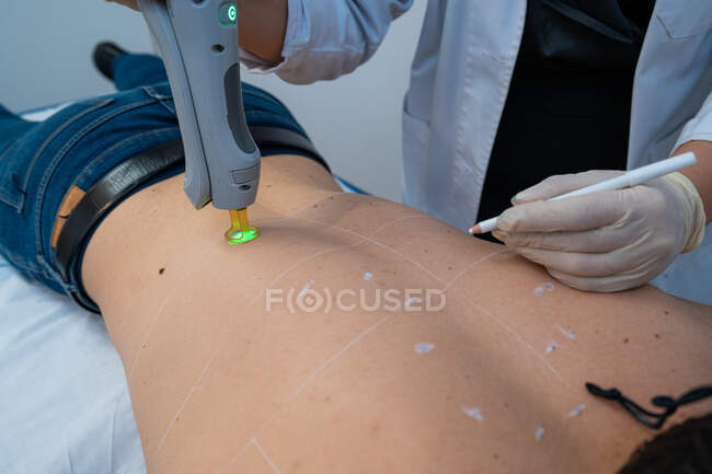 Maître méconnaissable utilisant le laser moderne sur le dos du client masculin pour l'épilation dans la clinique de beauté — Photo de stock