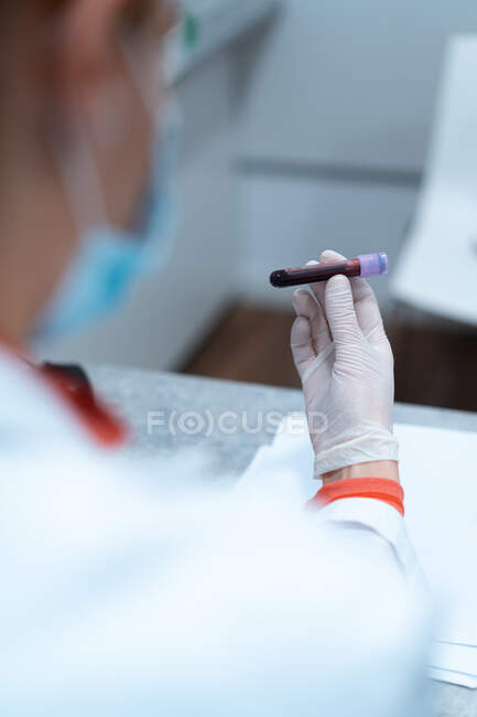 Médico femenino irreconocible en máscara y guantes sosteniendo tubo con muestra de sangre en laboratorio moderno en clínica - foto de stock