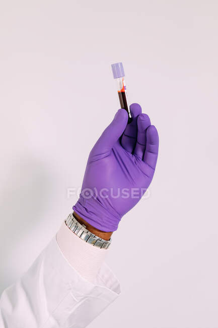 Crop anonymous doctor in medical glove demonstrating test tube with blood sample on white background — Stock Photo