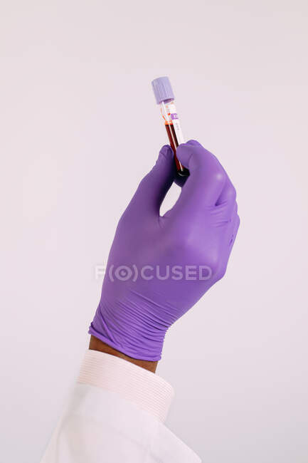 Crop anonymous doctor in medical glove demonstrating test tube with blood sample on white background — Stock Photo